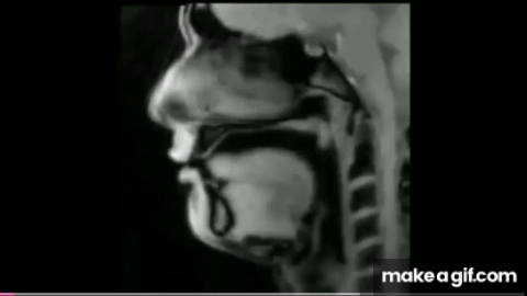The XRay Art Effect: Illuminating the Enigma at the Intersection of Art and Medicine 3 Live MRI of human tongue while talking